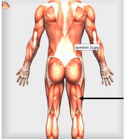 <p><span>Which of these muscles is indicated by the arrow?</span></p>