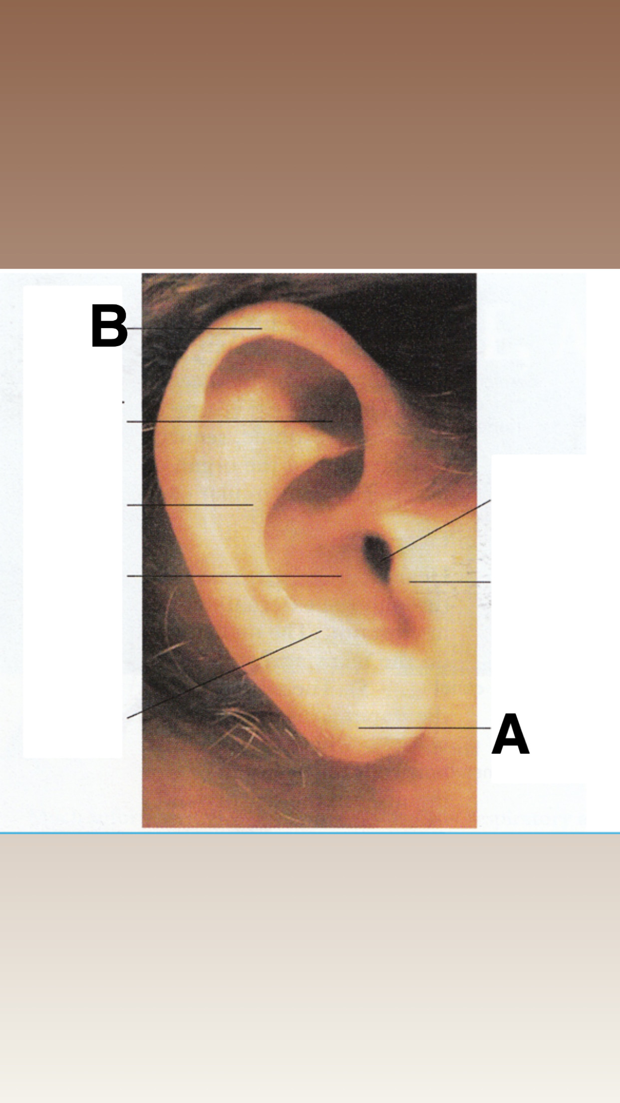 <p>Outter ear</p>
