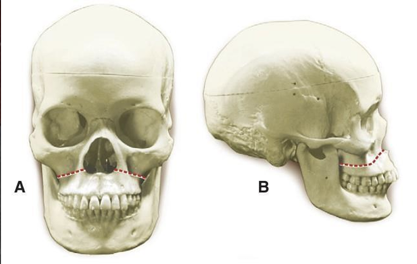<p>horizontal </p>