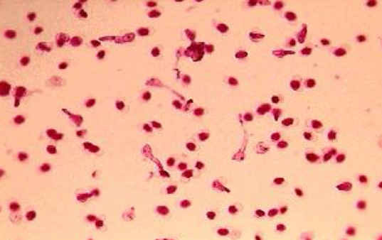 <p>Structures in Pine Strobili that contain sperm.</p>