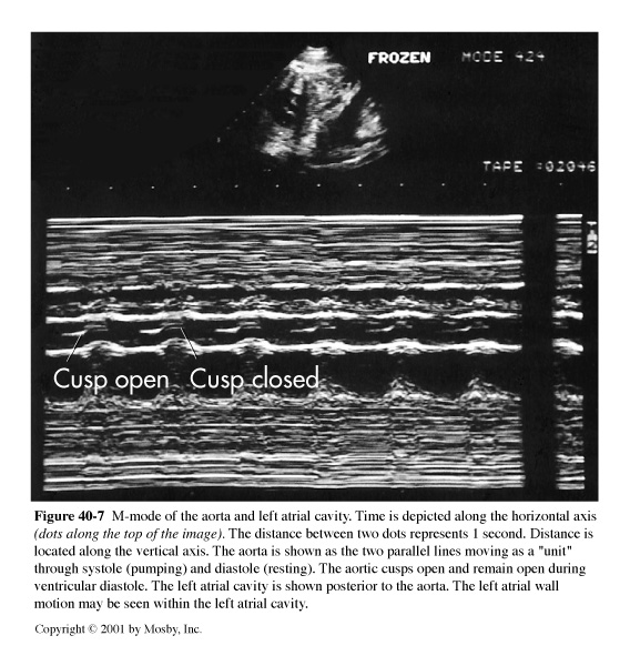 <p>This is image is example of ?</p>