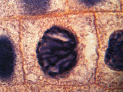 <p>Identify the phase of the cell cycle.</p>