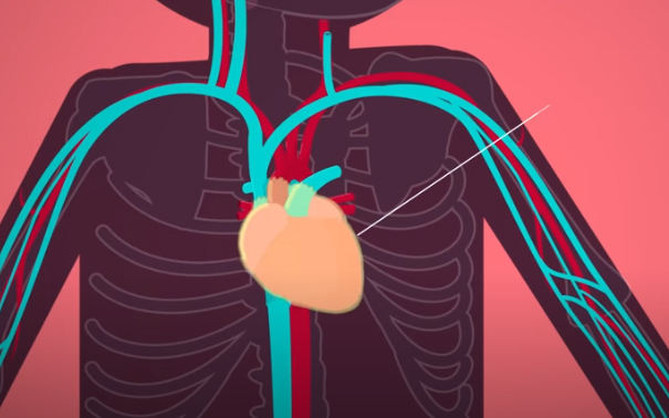 <p><span>The heart rests in a double-walled sac called the ____________________ .</span></p>