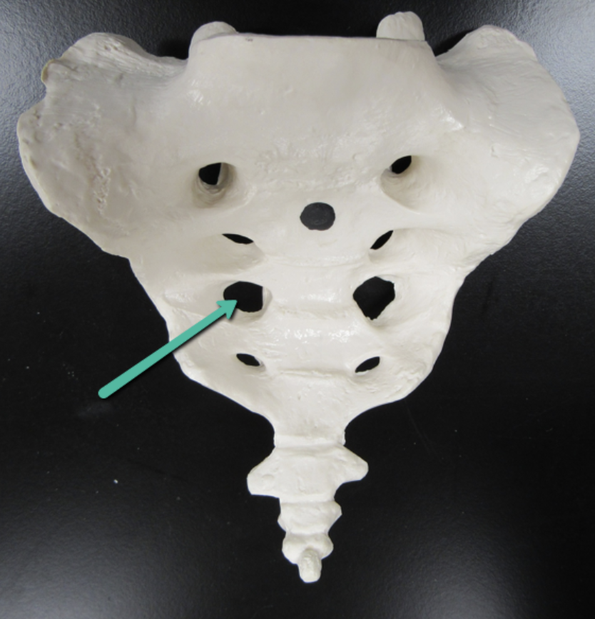 <p><span><strong>Identify the bone marking indicated by the pointer.</strong></span></p>