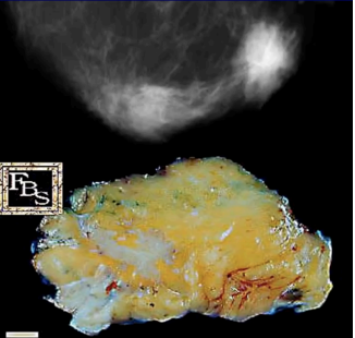<p>What pathology?</p>