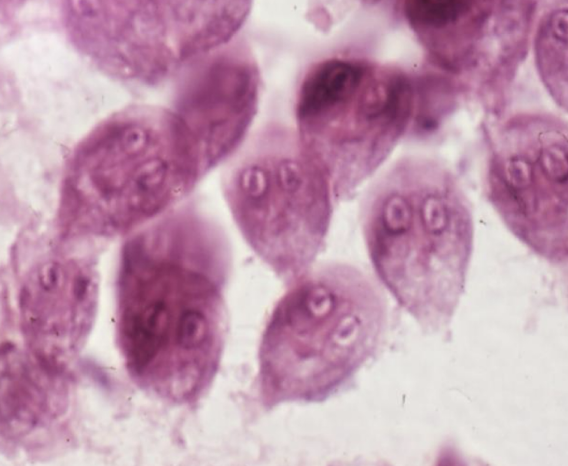 <p>What Flagellate is this?</p>