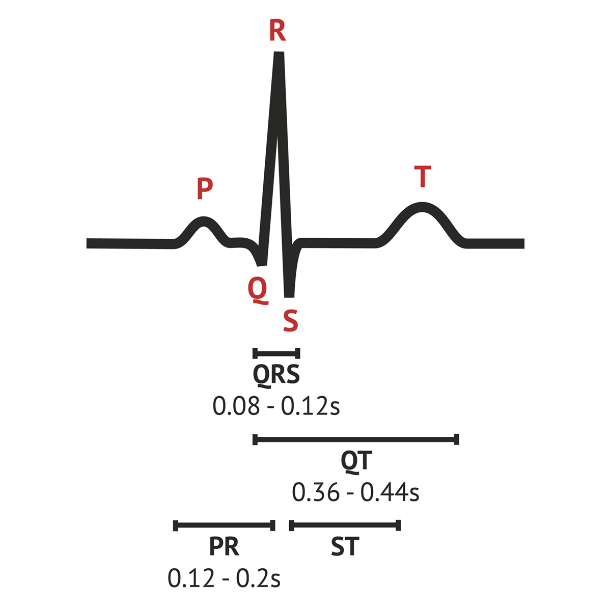 <ol><li><p><span style="background-color: transparent; font-family: "Times New Roman", serif;"><strong>P Wave:</strong> Atrial depolarization (squeeze).</span></p></li><li><p><span style="background-color: transparent; font-family: "Times New Roman", serif;"><strong>PR Interval:</strong> Time for the signal to travel from the SA node through the AV node (the "gatekeeper").</span></p></li><li><p><span style="background-color: transparent; font-family: "Times New Roman", serif;"><strong>QRS Complex:</strong> Ventricular depolarization (the big squeeze). Should be narrow.</span></p></li><li><p><span style="background-color: transparent; font-family: "Times New Roman", serif;"><strong>T Wave:</strong> Ventricular repolarization (the reset).</span></p></li><li><p><span style="background-color: transparent; font-family: "Times New Roman", serif;"><strong>ST Segment:</strong> The pause between depolarization and repolarization; it should be flat on the "isoelectric line".</span></p></li></ol><p></p>