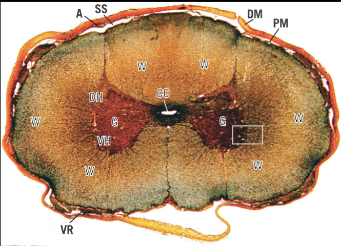 <p>in the Spinal cord, where is the White matter located?</p>