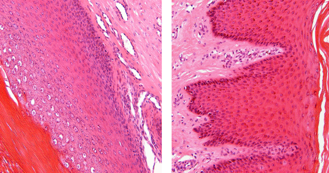 <p>soort epitheel</p>