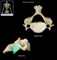 <p>Category: Typical Vertebra</p>