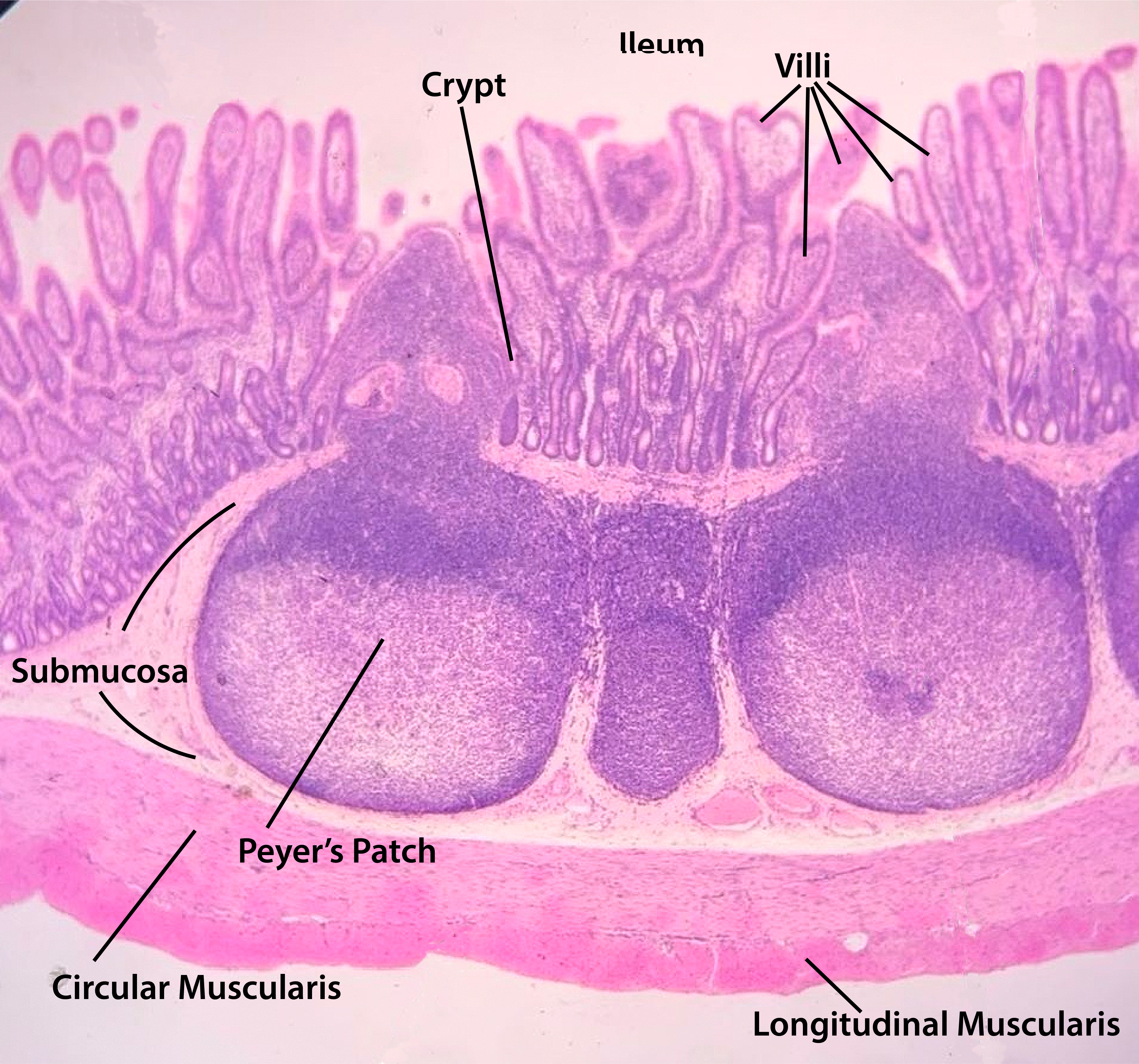 <p>ileum</p>