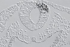 <p>for the chick-quail … technique … tissue was transplanted into the … embryo, and since quail cells are more … they were used to map the … pathway and fate of … … cells</p>