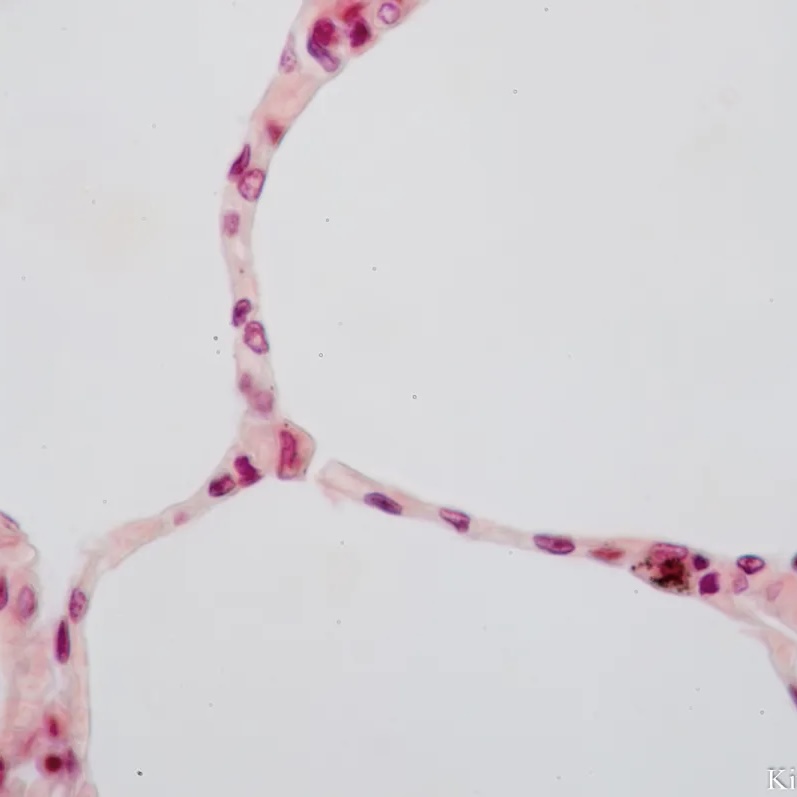 <p>Simple Squamous Epithelium — Identification</p>