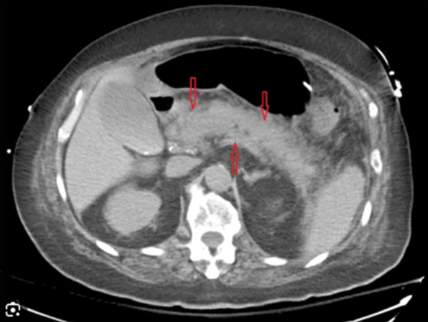 <p>diagnosis</p>