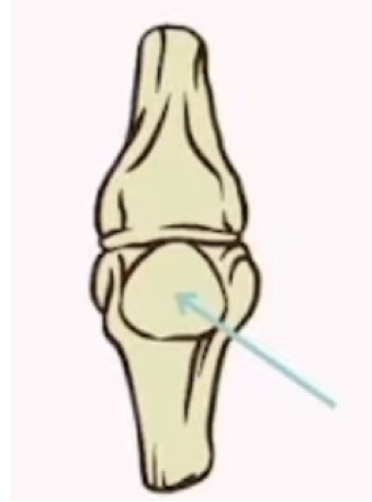 <p>name the bone and what bone shape it is </p>
