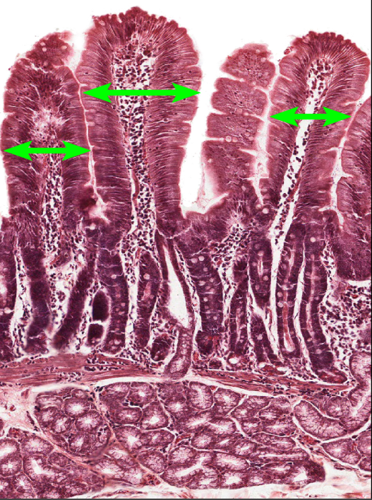 <p>Small Intestine</p><p><strong>NOTICE: THE FINGER-LIKE PROJECTIONS (VILLI) WITH OPEN SPACE INSIDE AND A FEW GRAY/BLUE GOBLET CELLS ALONG THE SIDES (NOT AS MANY AS LARGE INTESTINE</strong></p>