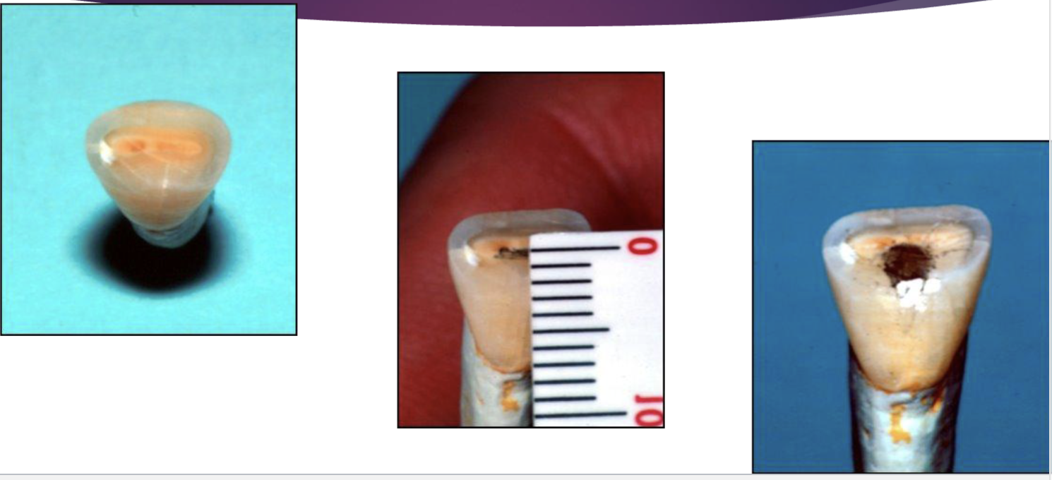 <p>incisal edge can be worn to or beyond the incisal limit</p>