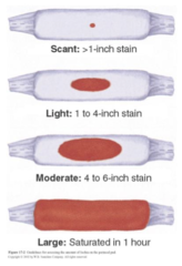 <p>- Discharge which rids uterus of debris</p><p>- Classified according to appearance/contents</p><p>- document type and amount</p>
