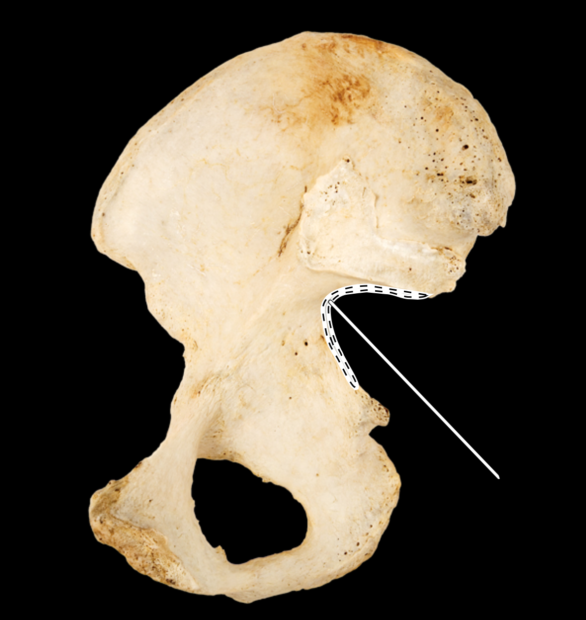 <p>medial view, right side</p>