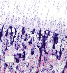 <p>osteoprogenitor cells are invading this area</p>