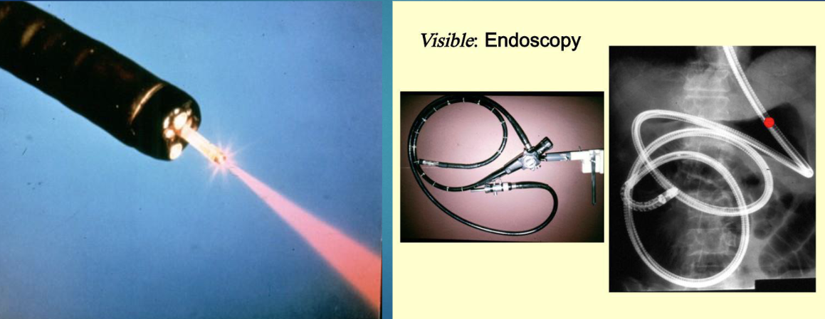 <p>non surgical procedure where doctor uses a thin flexible tube equipped with light and camera (endoscope) to examine the inside of the body </p><ul><li><p>digestive tract usually </p></li></ul><p></p>