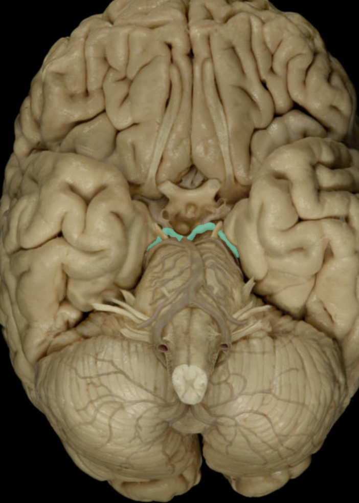 <p>Identify the artery to the brain (circle of willis)</p>