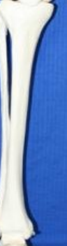 <p>What bone is this? What view of the bone is this?</p>