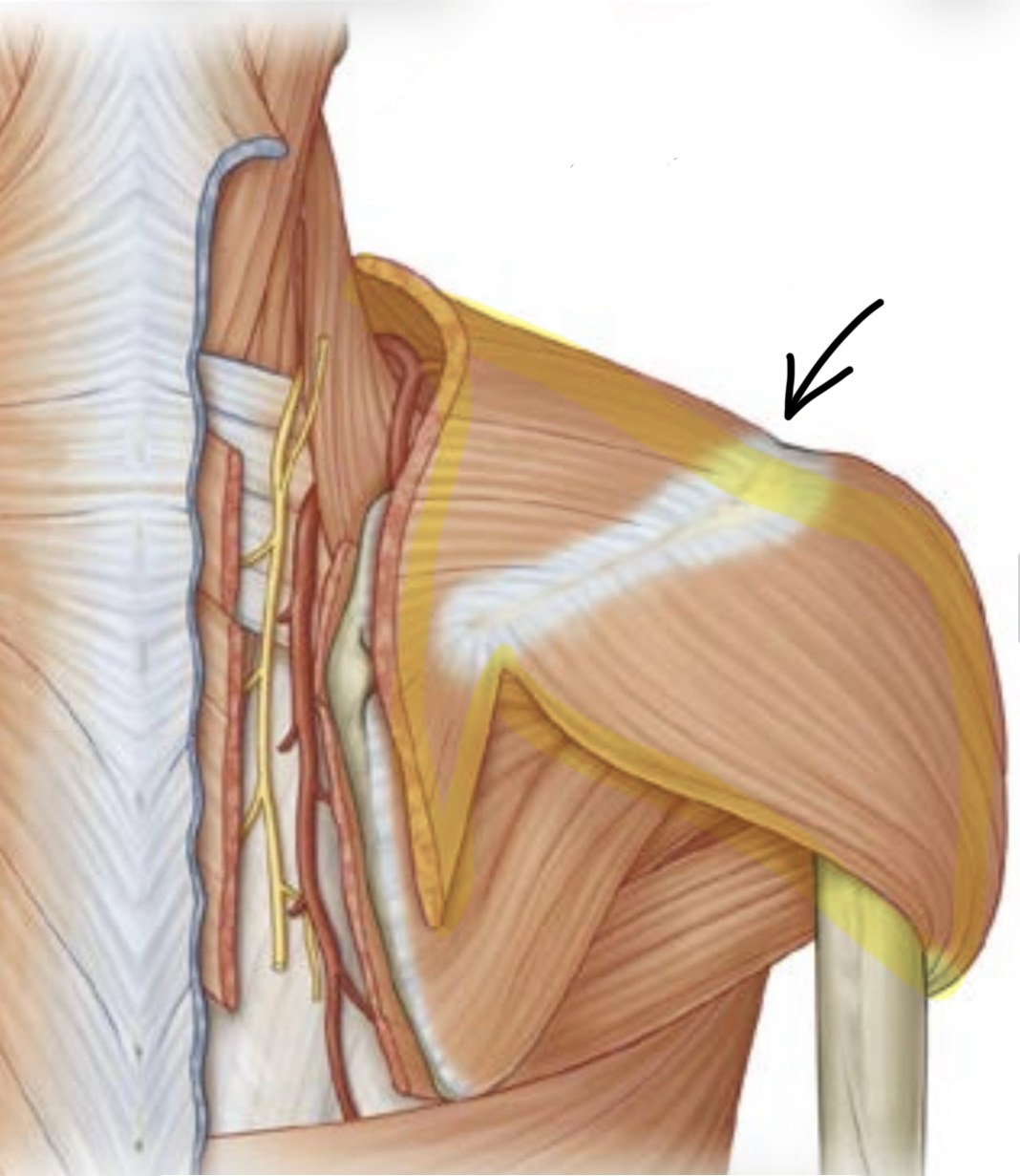 term image