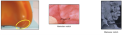 <p>When border molding, how do you capture the pterygomaxillary notch or hamular notch?</p>