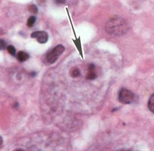 <p>What parasite is this?</p>
