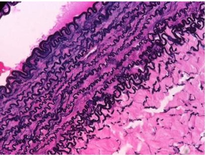 <p>what tissue is this? </p>