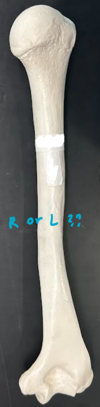 <p>ID left or right Humerus </p>