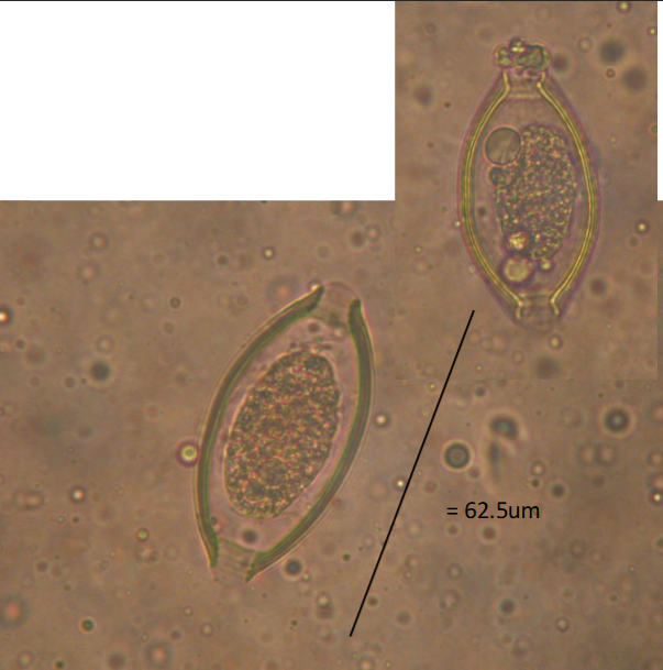 <p>What is the kingdom, phylum, order, and family of this parasite</p>