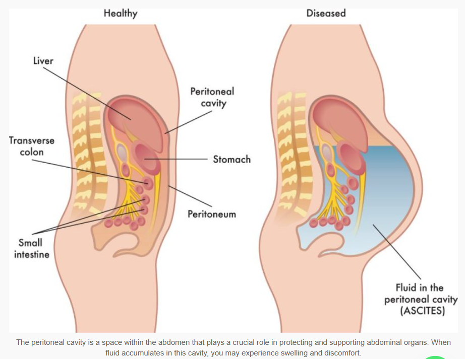 <p>fluid-filled space inside the abdomen; the fluid acts as a frictionless lubricant that allows digestive organs to expand, contract, and slide; between the 2 peritoneum</p>