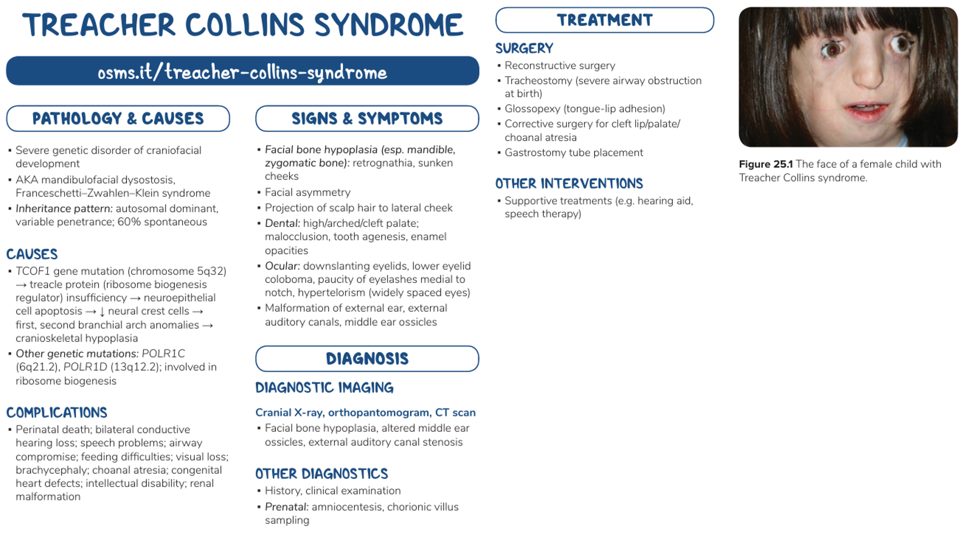 Treacher Collins syndrome