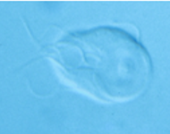<p>Giardia</p>