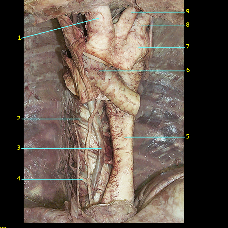 <p>What is 3 pointing to?</p>
