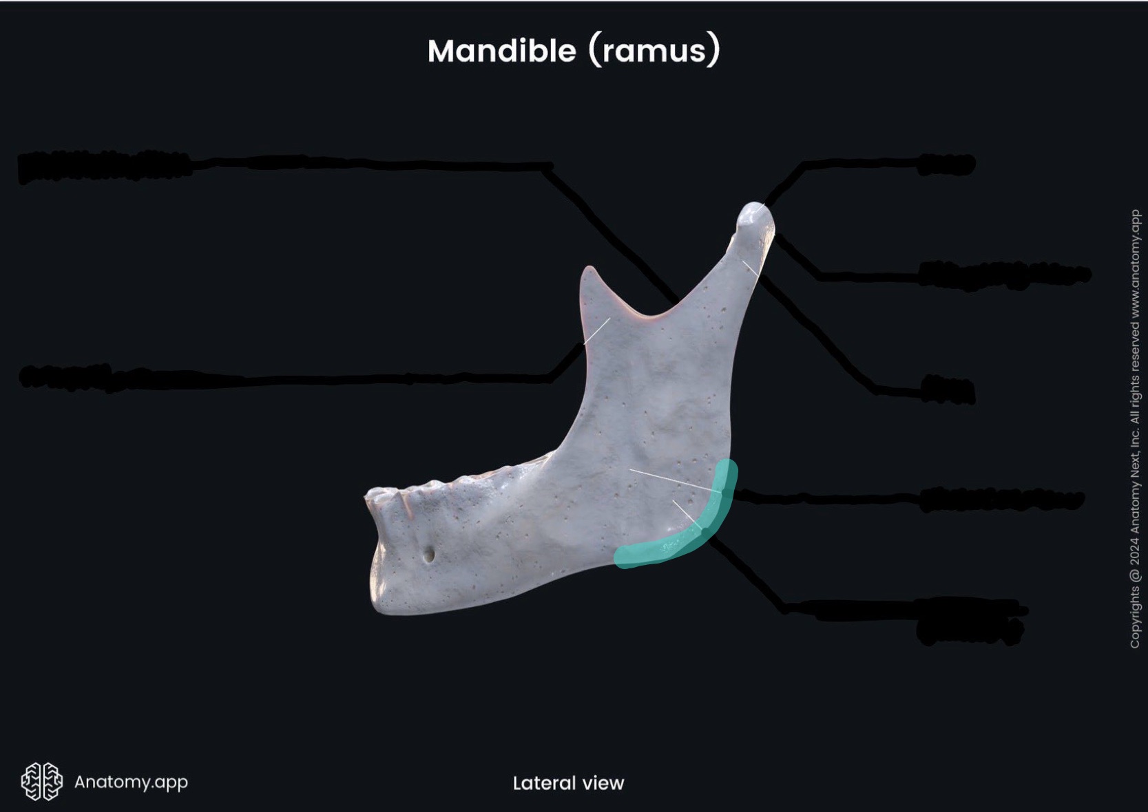 <p>What is the highlighted bony landmark</p>