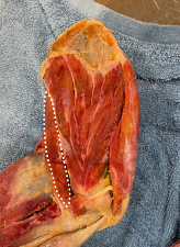 <p>Identify the muscle</p>