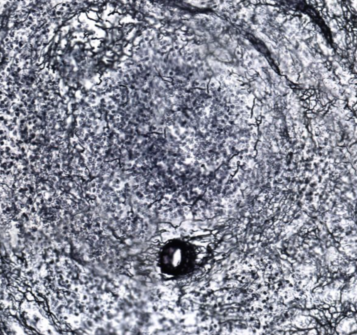 <p><span style="background-color: transparent;">tissue function</span></p>