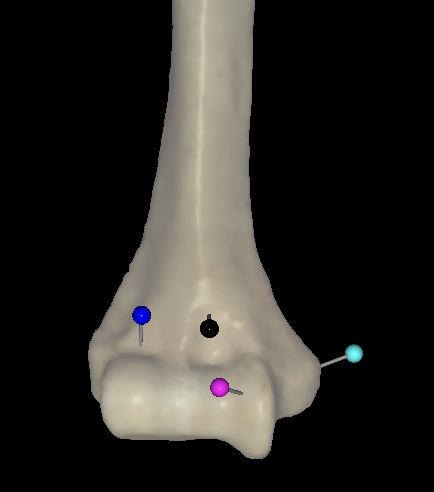 <p>What is the pink pin called on the right humerus?</p>