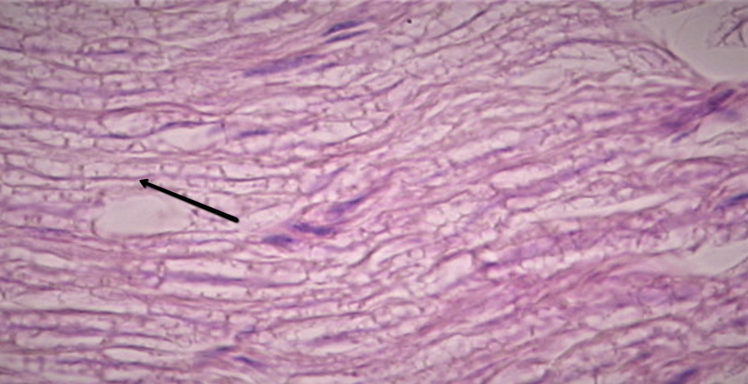 <p><span><strong>Identify the thin, horizontal, dark structure at the tip of the pointer.</strong></span></p>