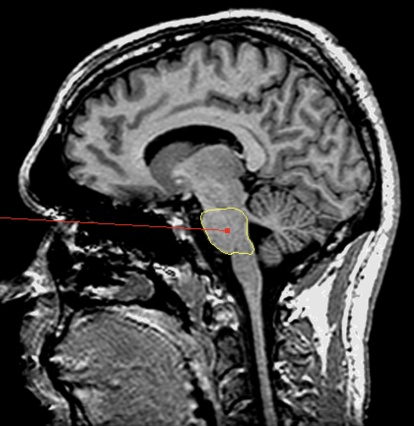 <p>What is the area highlighted called?</p>