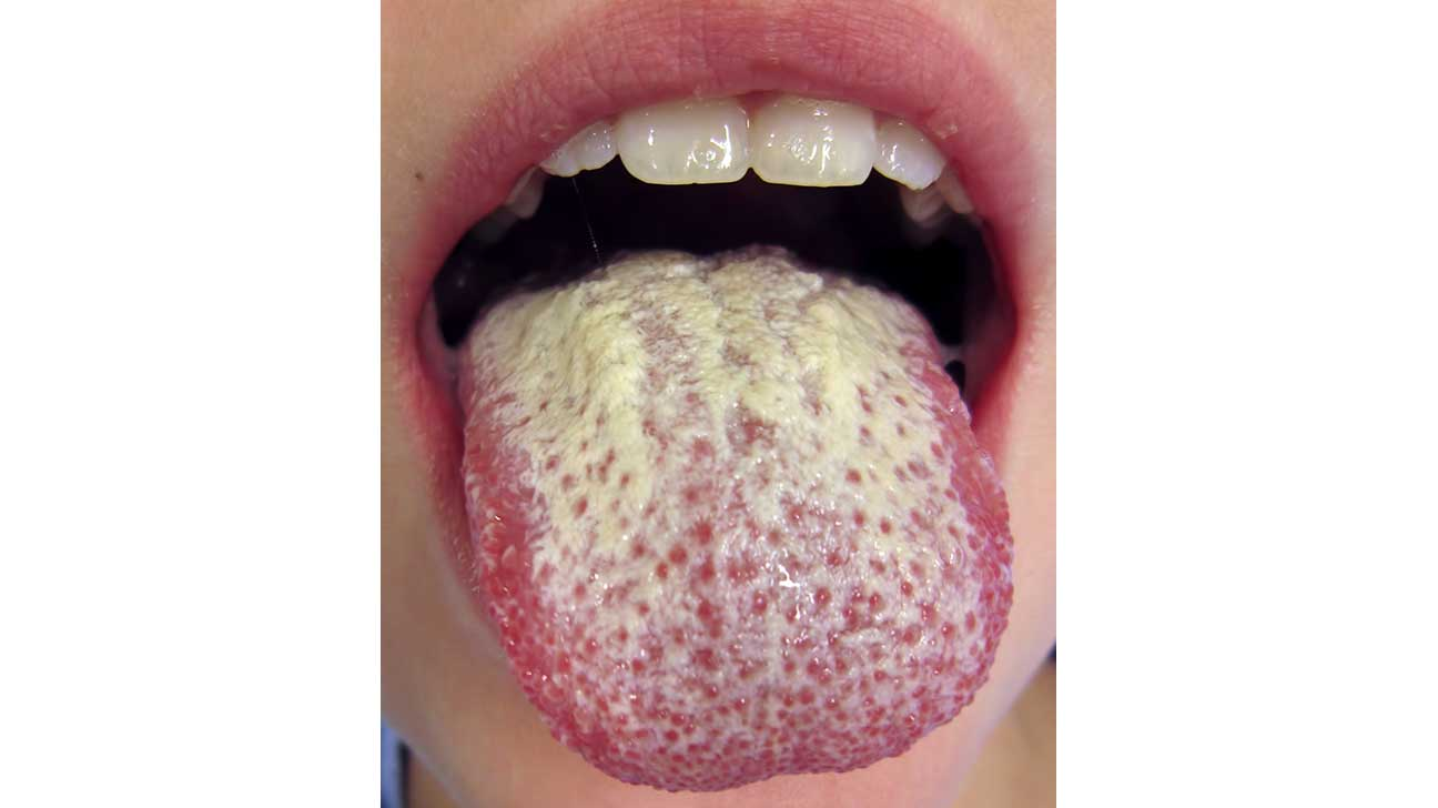 <p>What is this?? Explain!</p><p>(for the love of all things good please rinse after using an inhaler)</p>