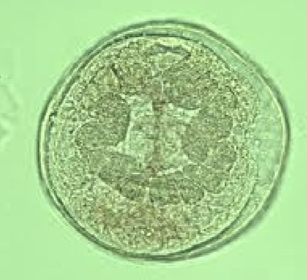 <p>What helminth/fluke/parasitic worm is this?</p>