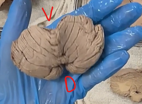 <p>V: ventral (front)</p><p>D: dorsal (back)</p><p>The cerebellum can be separated into left and right hemispheres. </p>