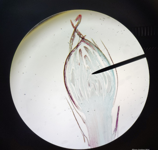 <ol><li><p>Name the phylum</p></li><li><p>Name it</p></li></ol><p></p>