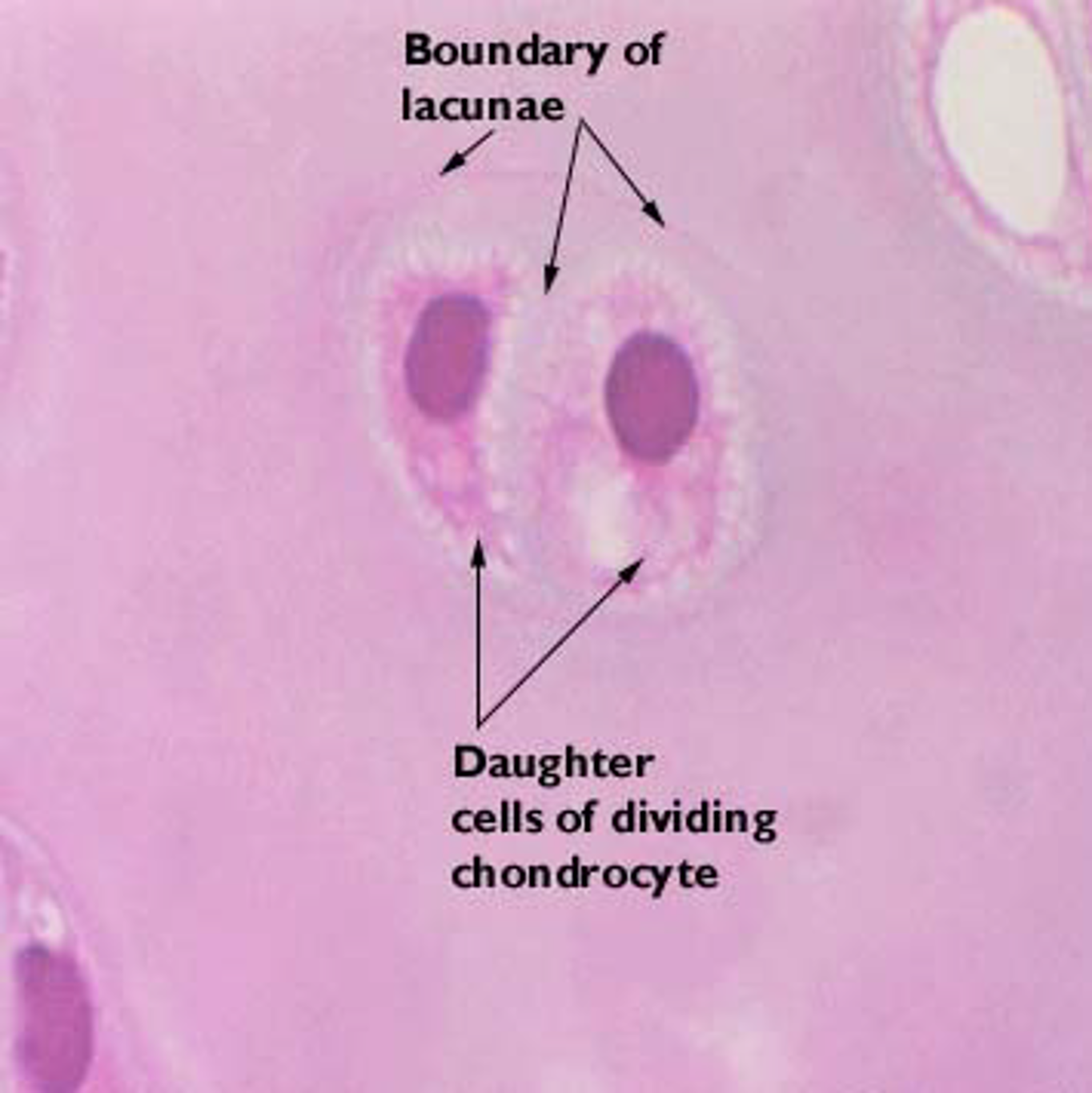 <p>Chondrocytes </p>
