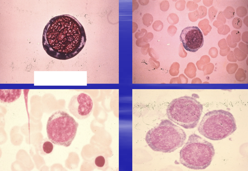 <p>round, primitive nucleus, centrally located with one or more nucleoli. delicate chromatin w/ no clumping. dark blue nucleus. cytoplasm royal blue and abundant. </= 1% in bone marrow.</p>