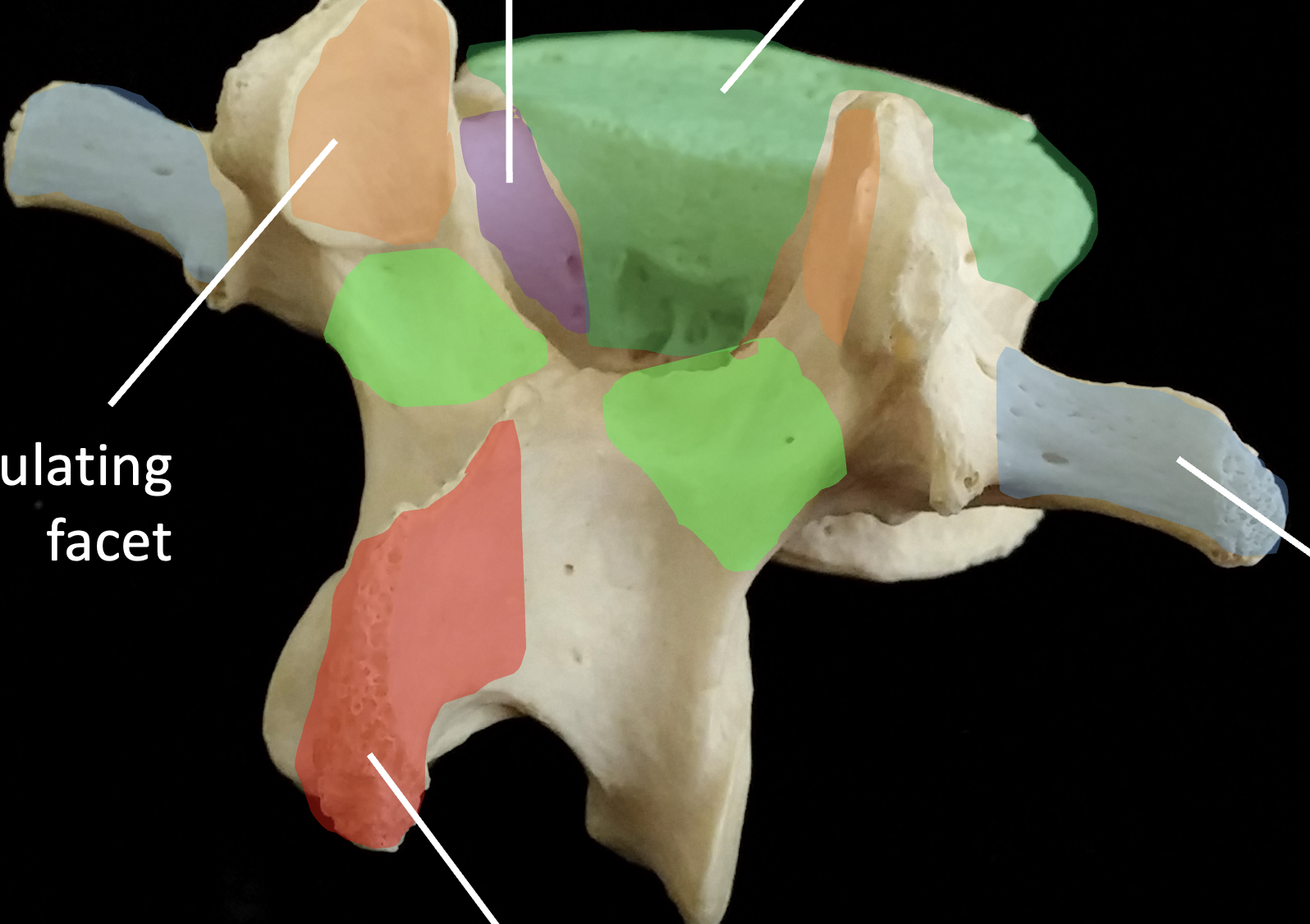 <p>What is the light green region highlighted on the lumbar vertebrae?</p>